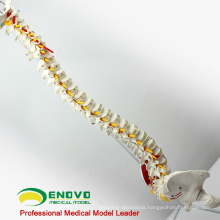 SPINE05 12377 Medical Science Human Flexible Spine Painted Muscles, Life-Size Spine Models